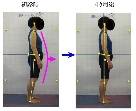 Core stability of posture