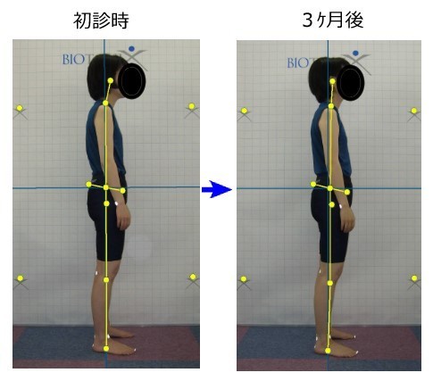 Analysis of posture changes