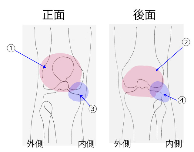 膝関節のシェーマ