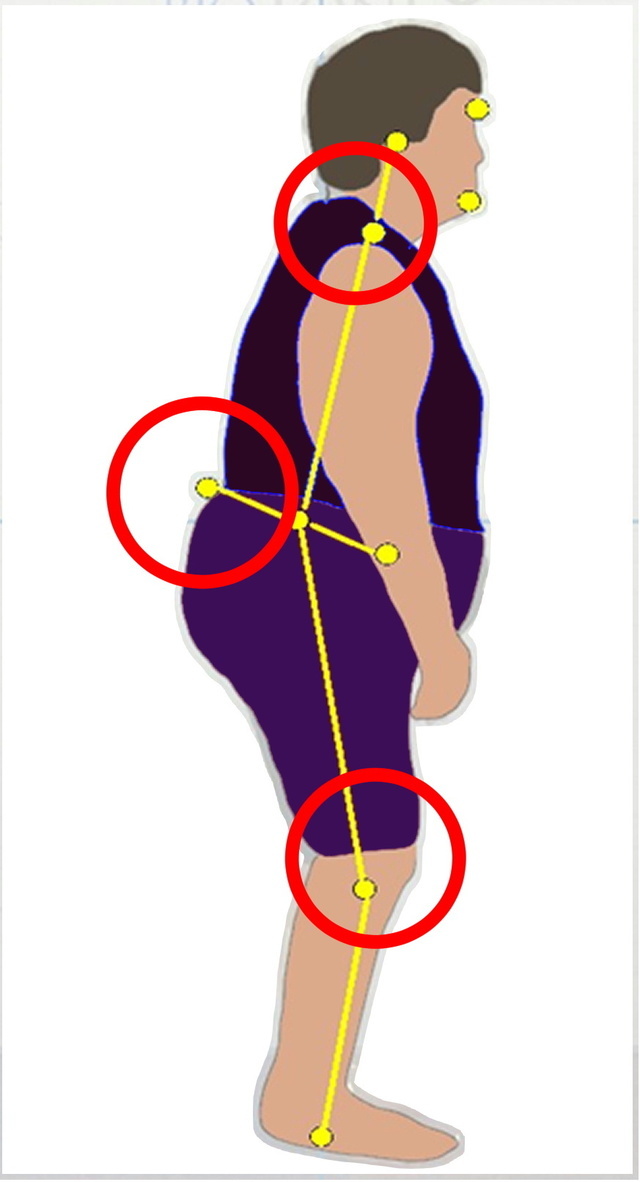 変形性膝関節症の方に多い姿勢