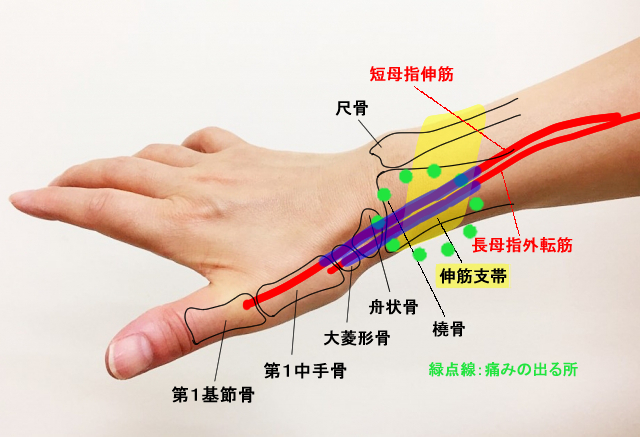 筋 腕 痛い の が