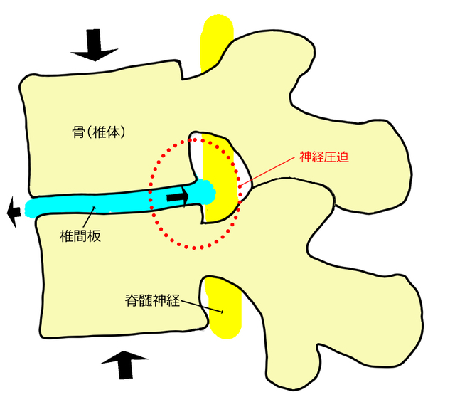 姿勢プリント　比較