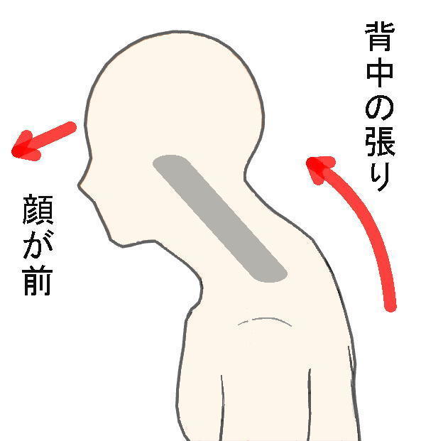 ストレートネックネック