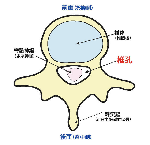 脊柱管狭窄症の上から見た図