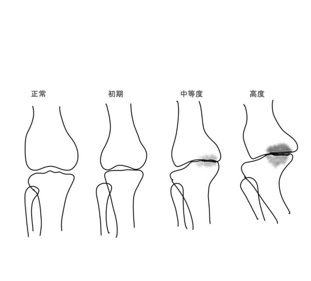 Ｏ伽を前と横から見た写真