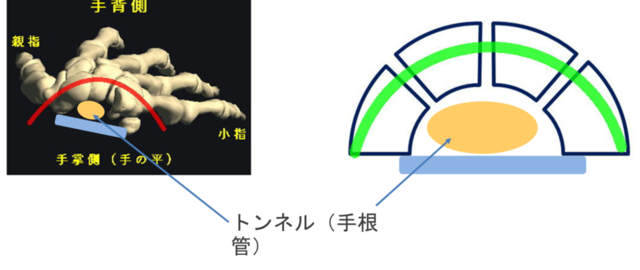 手や手首の痛みの写真