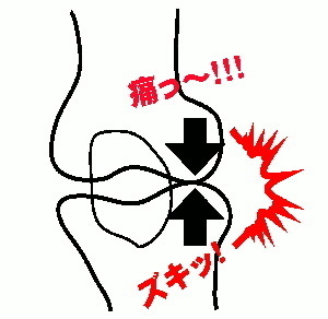 骨と骨が当たって痛い！