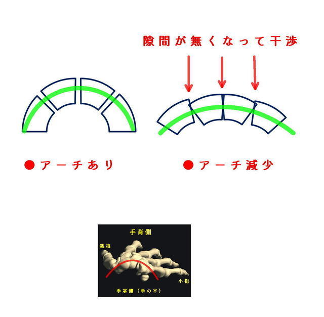 手や手首の痛みの写真