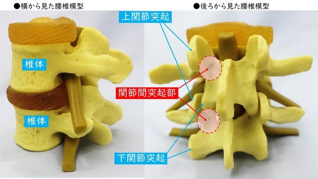 分離症の起るところ