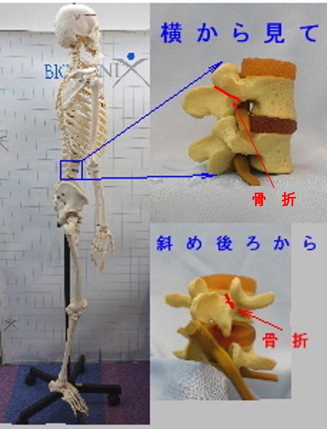 分離症の起るところ