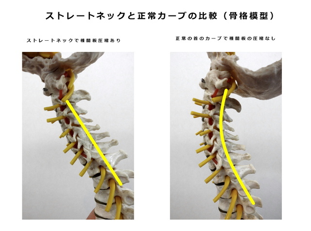背骨にＳ字状のカーブ
