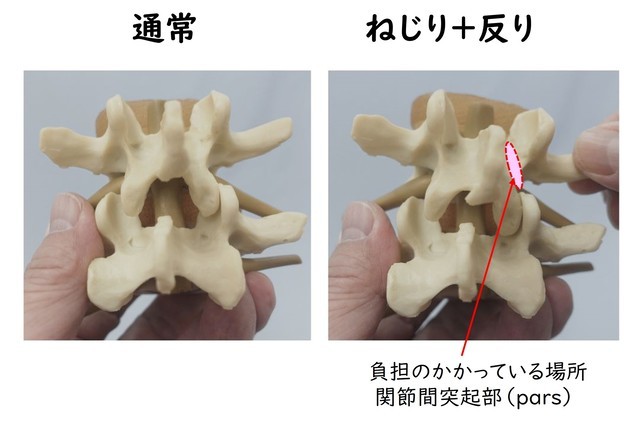 分離症の起るところ
