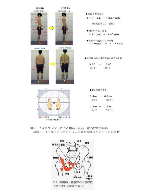 Analysis of posture changes