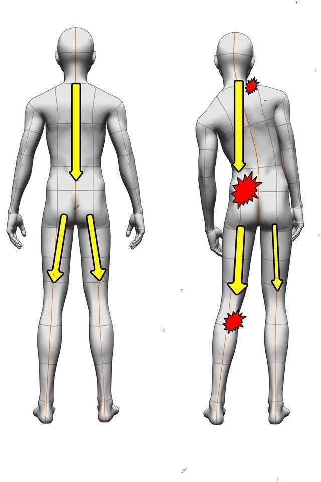 effects of bad posture