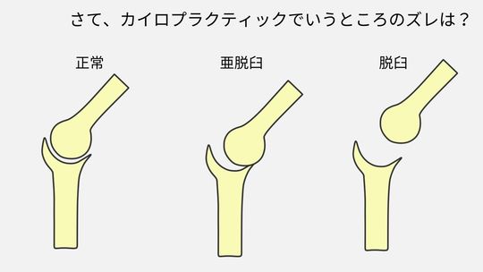カイロプラクティック概論(鈴木正教) / あんず古書店 / 古本